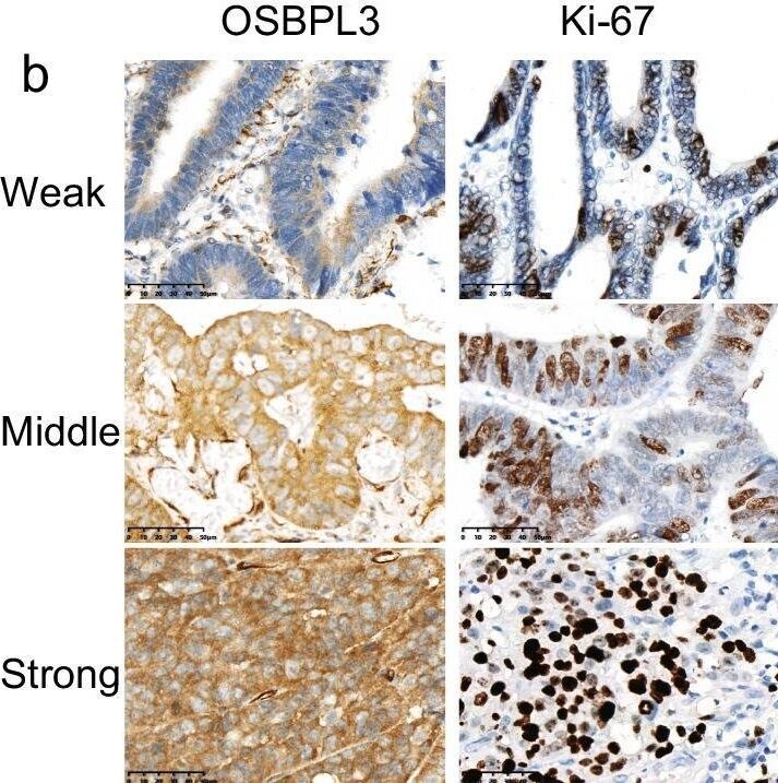 OSBPL3 Antibody - BSA Free