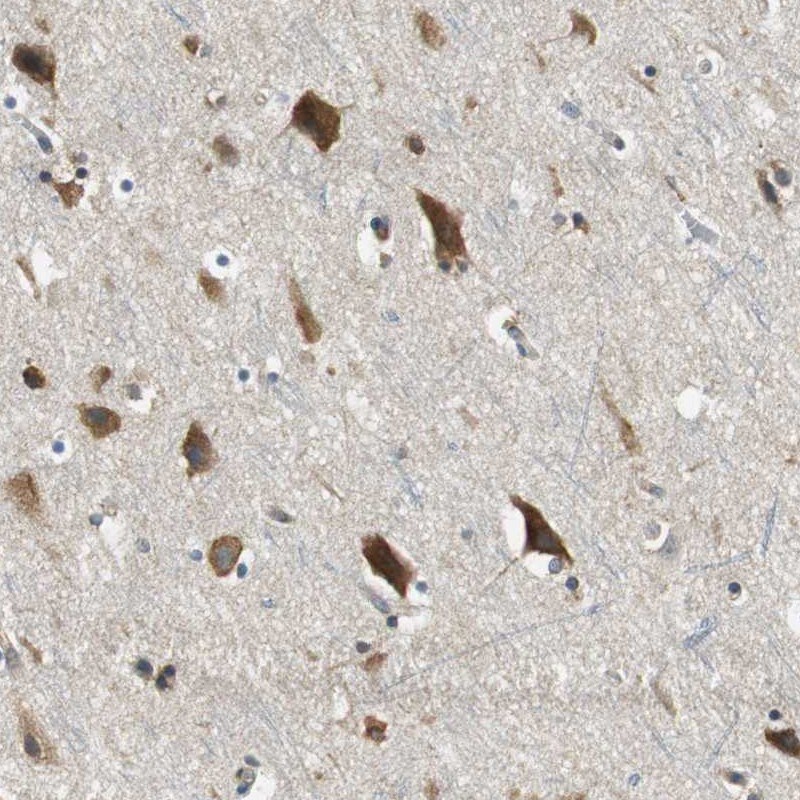 CNOT3 Antibody - BSA Free Immunohistochemistry-Paraffin: CNOT3 Antibody [NBP1-82971]