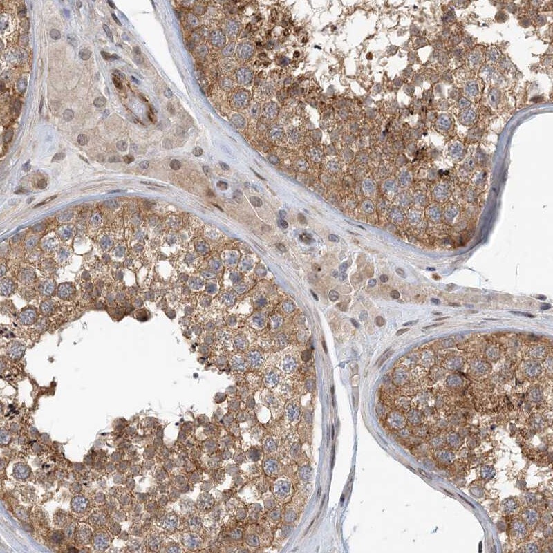 MAPKBP1 Antibody - BSA Free Immunohistochemistry: MAPKBP1 Antibody - BSA Free [NBP1-82984]