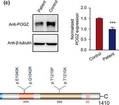 POGZ Antibody - BSA Free