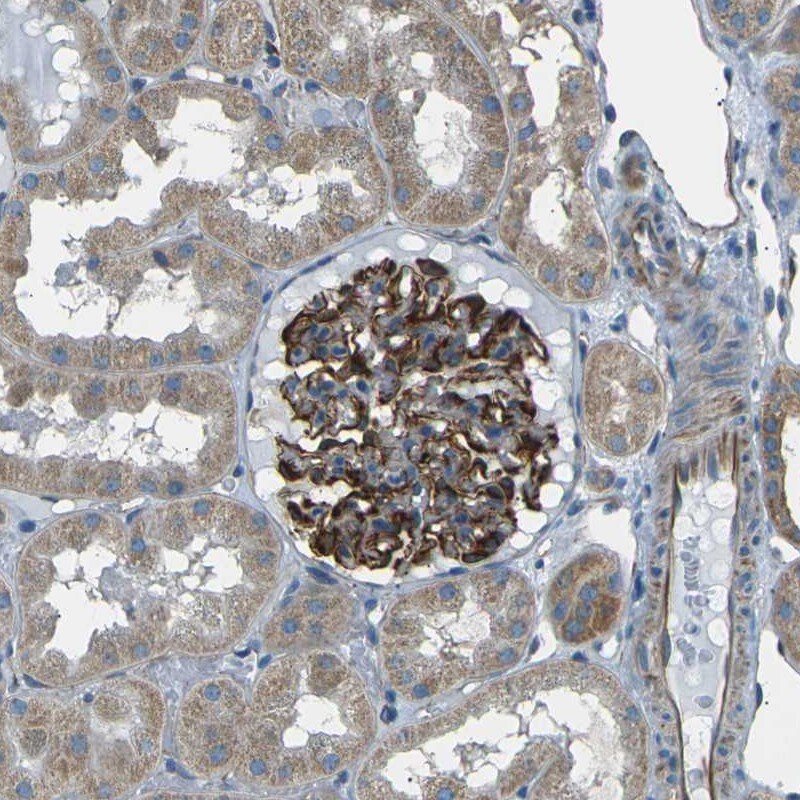 SLK Antibody - BSA Free Immunohistochemistry-Paraffin: SLK Antibody [NBP1-83024]