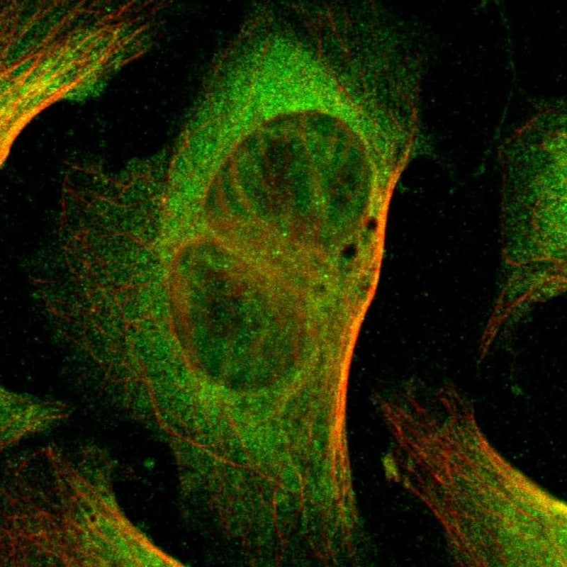 USP10 Antibody - BSA Free Immunocytochemistry/ Immunofluorescence: USP10 Antibody [NBP1-83028]