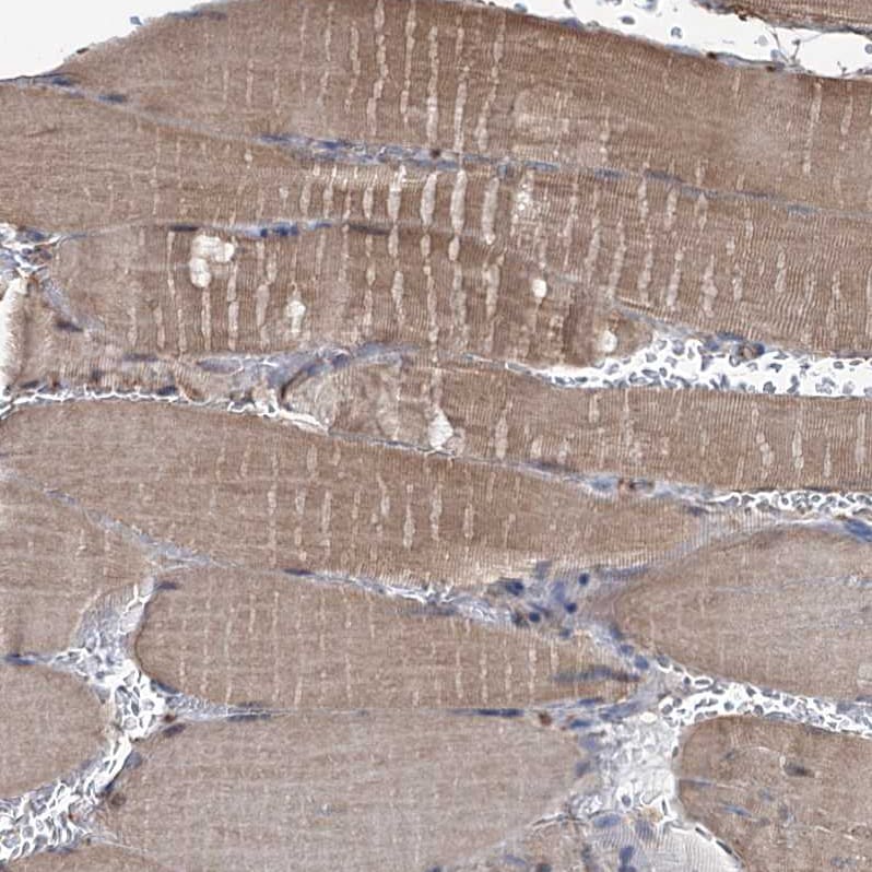 Lipin 1 Antibody - BSA Free Immunohistochemistry-Paraffin: Lipin 1 Antibody [NBP1-83030]