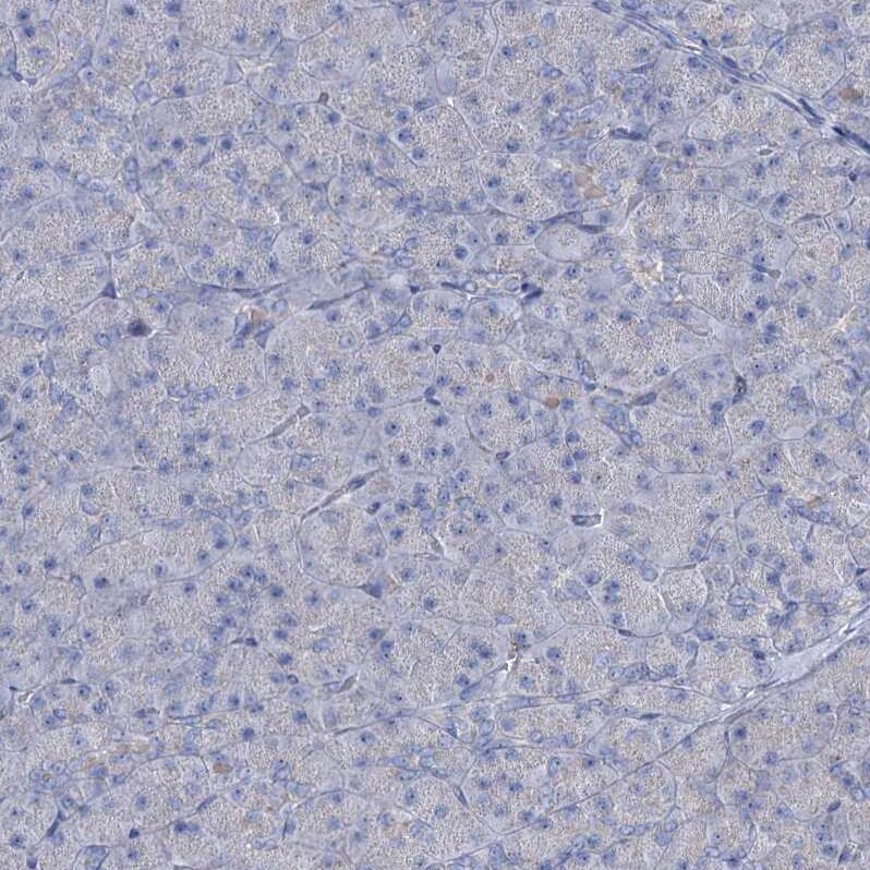 Lipin 1 Antibody - BSA Free Immunohistochemistry-Paraffin: Lipin 1 Antibody [NBP1-83030]