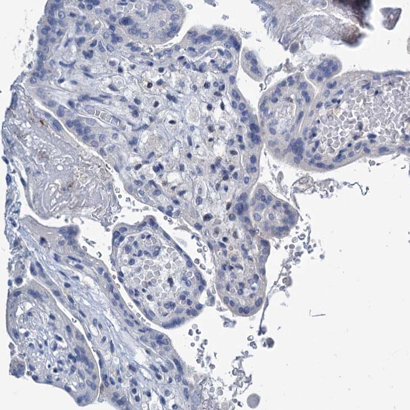 Lipin 1 Antibody - BSA Free Immunohistochemistry-Paraffin: Lipin 1 Antibody [NBP1-83030]