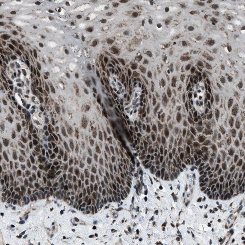 MORC3 Antibody - BSA Free Immunohistochemistry-Paraffin: MORC3 Antibody [NBP1-83036]