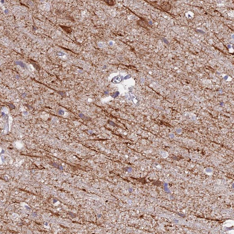 NEDD4 Antibody - BSA Free Immunohistochemistry: NEDD4 Antibody - BSA Free [NBP1-83044]