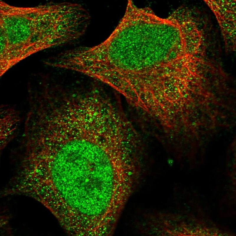 FTSJD2 Antibody - BSA Free Immunocytochemistry/ Immunofluorescence: FTSJD2 Antibody [NBP1-83046]