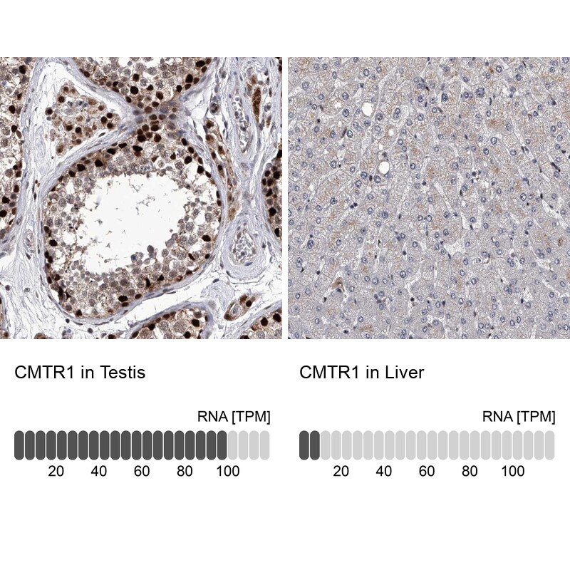 FTSJD2 Antibody - BSA Free Immunohistochemistry-Paraffin: FTSJD2 Antibody [NBP1-83046]