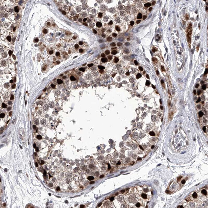 FTSJD2 Antibody - BSA Free Immunohistochemistry-Paraffin: FTSJD2 Antibody [NBP1-83046]