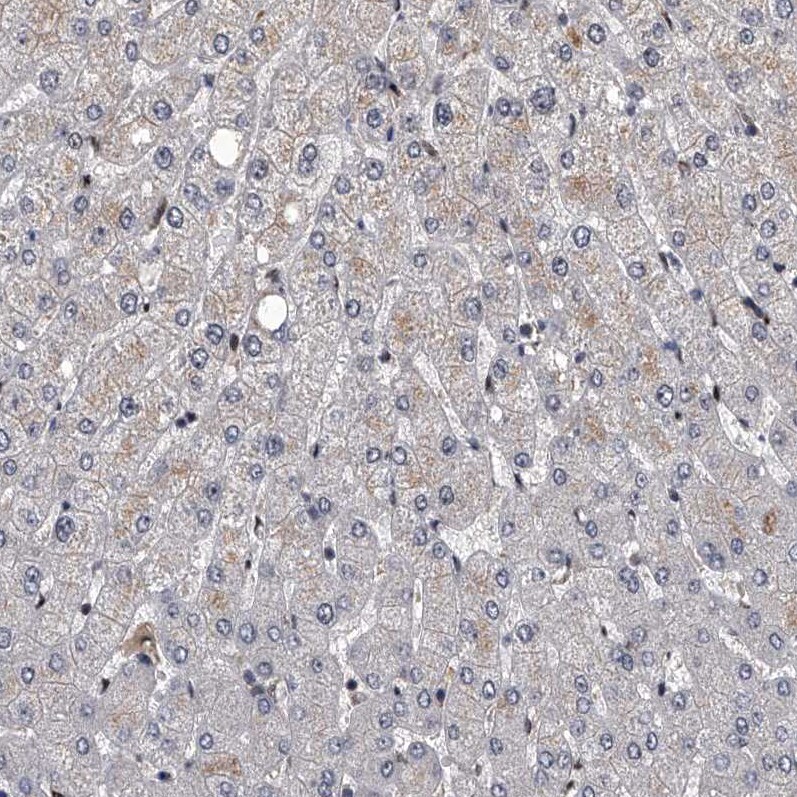 FTSJD2 Antibody - BSA Free Immunohistochemistry-Paraffin: FTSJD2 Antibody [NBP1-83046]