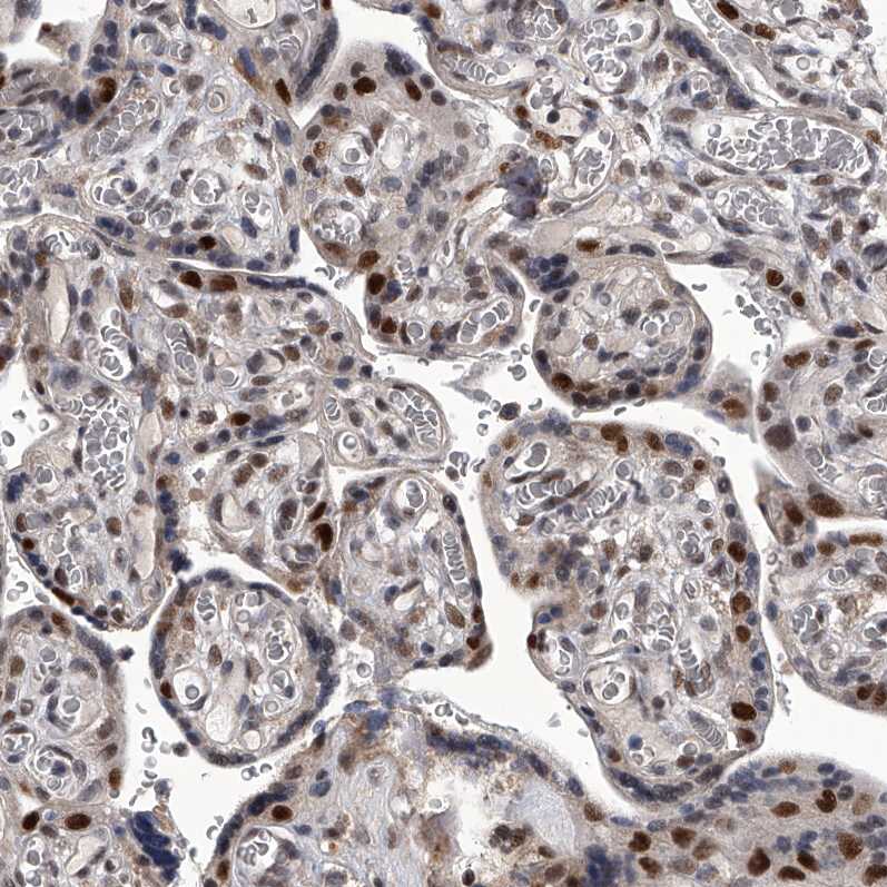 FTSJD2 Antibody - BSA Free Immunohistochemistry-Paraffin: FTSJD2 Antibody [NBP1-83046]