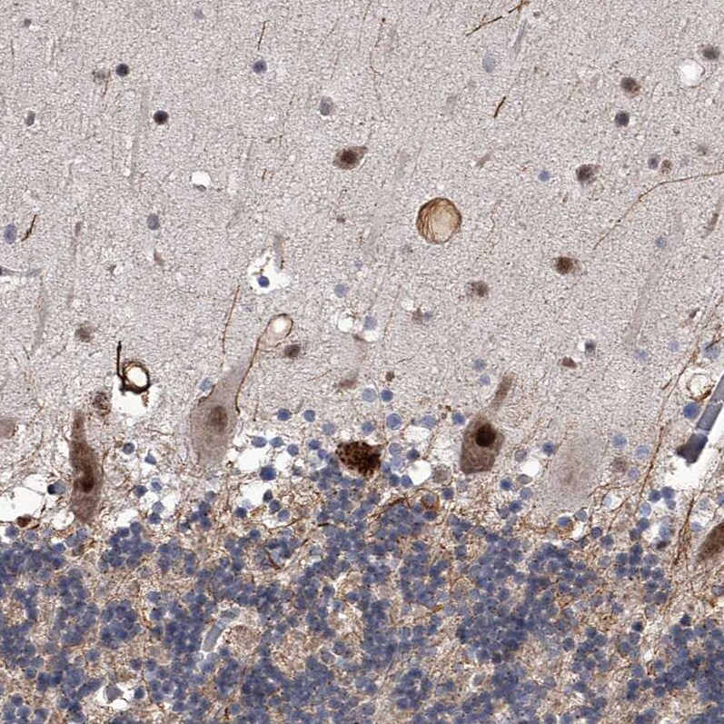 FTSJD2 Antibody - BSA Free Immunohistochemistry-Paraffin: FTSJD2 Antibody [NBP1-83046]