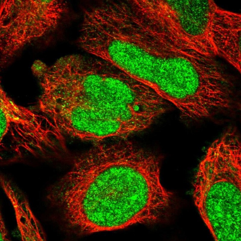FTSJD2 Antibody - BSA Free Immunocytochemistry/ Immunofluorescence: FTSJD2 Antibody [NBP1-83047]