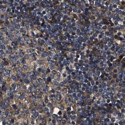 PPWD1 Antibody - BSA Free Immunohistochemistry-Paraffin: PPWD1 Antibody [NBP1-83050]
