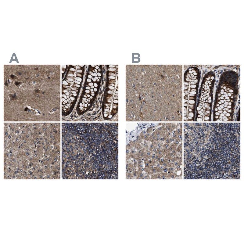 PPWD1 Antibody - BSA Free Immunohistochemistry-Paraffin: PPWD1 Antibody [NBP1-83050]