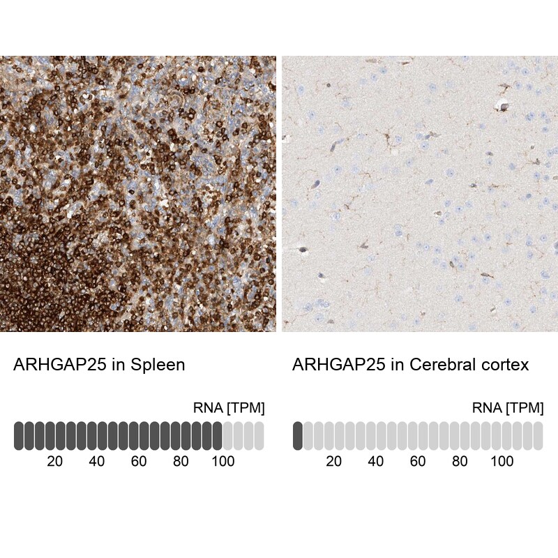 ARHGAP25 Antibody - BSA Free Immunohistochemistry-Paraffin: ARHGAP25 Antibody [NBP1-83053]