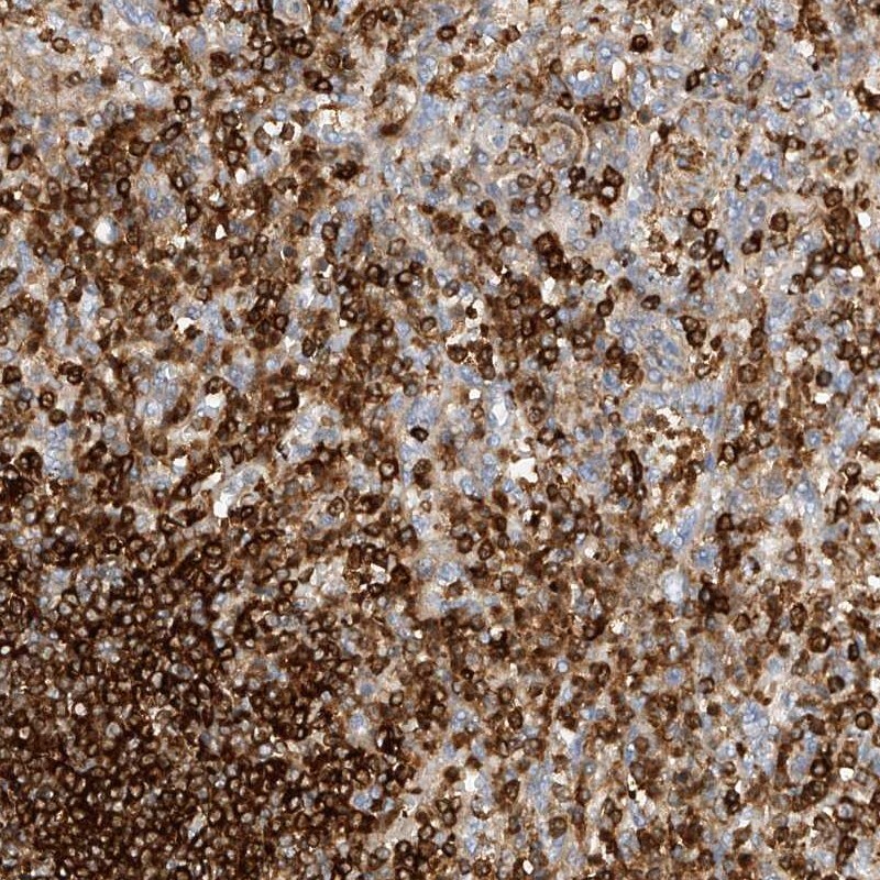 ARHGAP25 Antibody - BSA Free Immunohistochemistry-Paraffin: ARHGAP25 Antibody [NBP1-83053]
