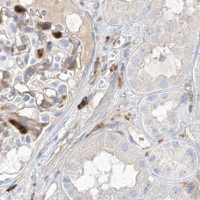 ARHGAP25 Antibody - BSA Free Immunohistochemistry-Paraffin: ARHGAP25 Antibody [NBP1-83053]