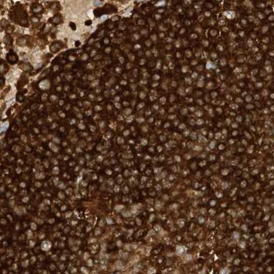 ARHGAP25 Antibody - BSA Free Immunohistochemistry-Paraffin: ARHGAP25 Antibody [NBP1-83053]
