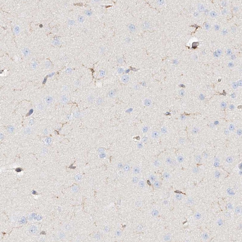 ARHGAP25 Antibody - BSA Free Immunohistochemistry-Paraffin: ARHGAP25 Antibody [NBP1-83053]