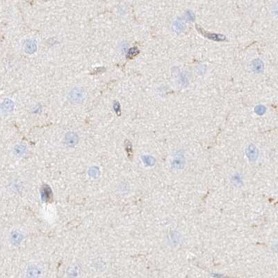 ARHGAP25 Antibody - BSA Free Immunohistochemistry-Paraffin: ARHGAP25 Antibody [NBP1-83053]