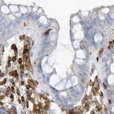 ARHGAP25 Antibody - BSA Free Immunohistochemistry-Paraffin: ARHGAP25 Antibody [NBP1-83053]