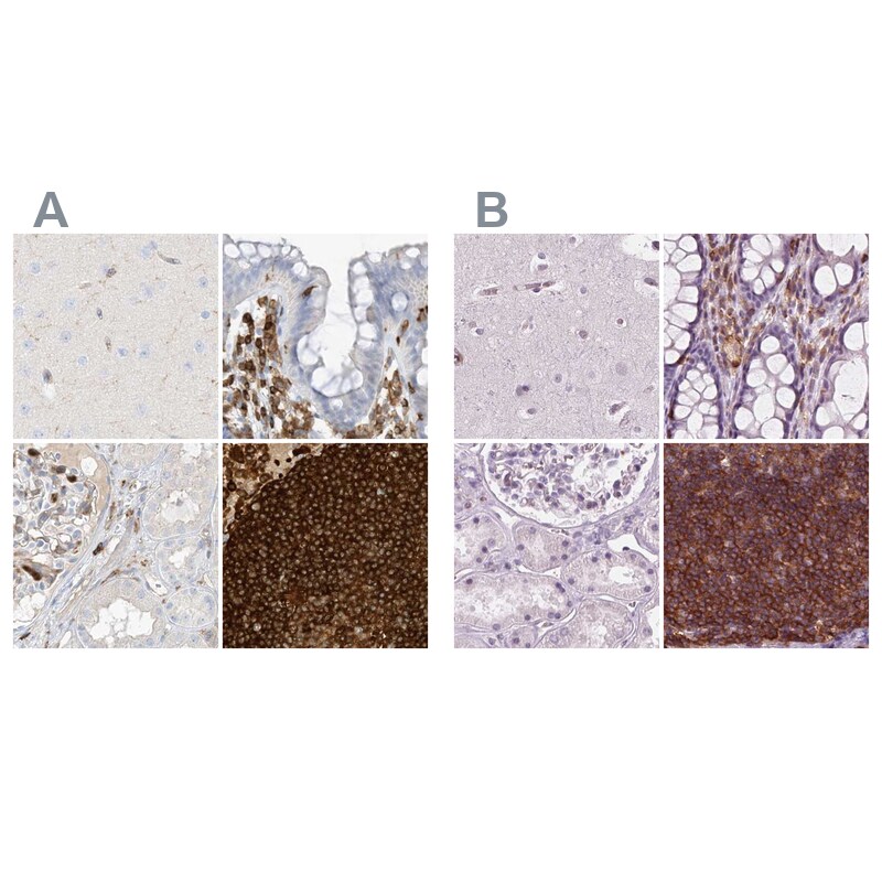 ARHGAP25 Antibody - BSA Free Immunohistochemistry-Paraffin: ARHGAP25 Antibody [NBP1-83053]