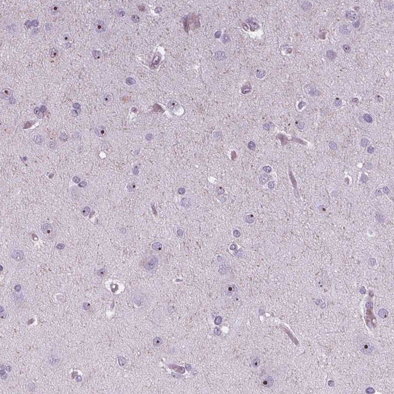 NOLC1 Antibody - BSA Free Immunohistochemistry-Paraffin: NOLC1 Antibody [NBP1-83058]