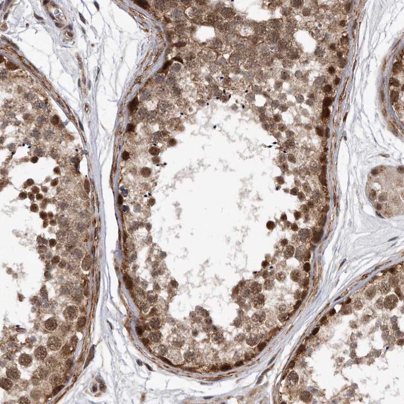 DUSP22 Antibody - BSA Free Immunohistochemistry-Paraffin: DUSP22 Antibody [NBP1-83078]