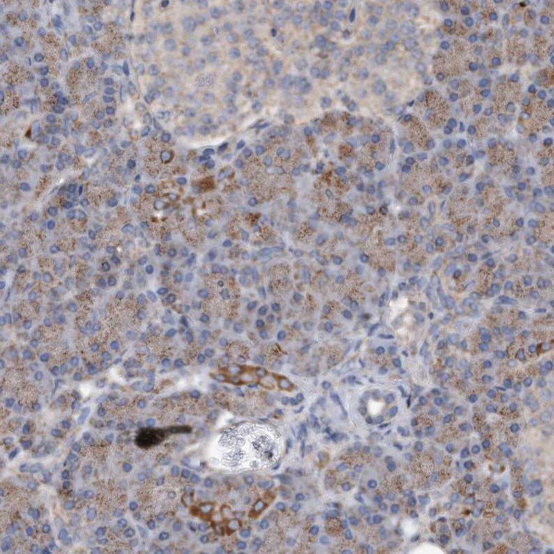 DUSP22 Antibody - BSA Free Immunohistochemistry-Paraffin: DUSP22 Antibody [NBP1-83078]