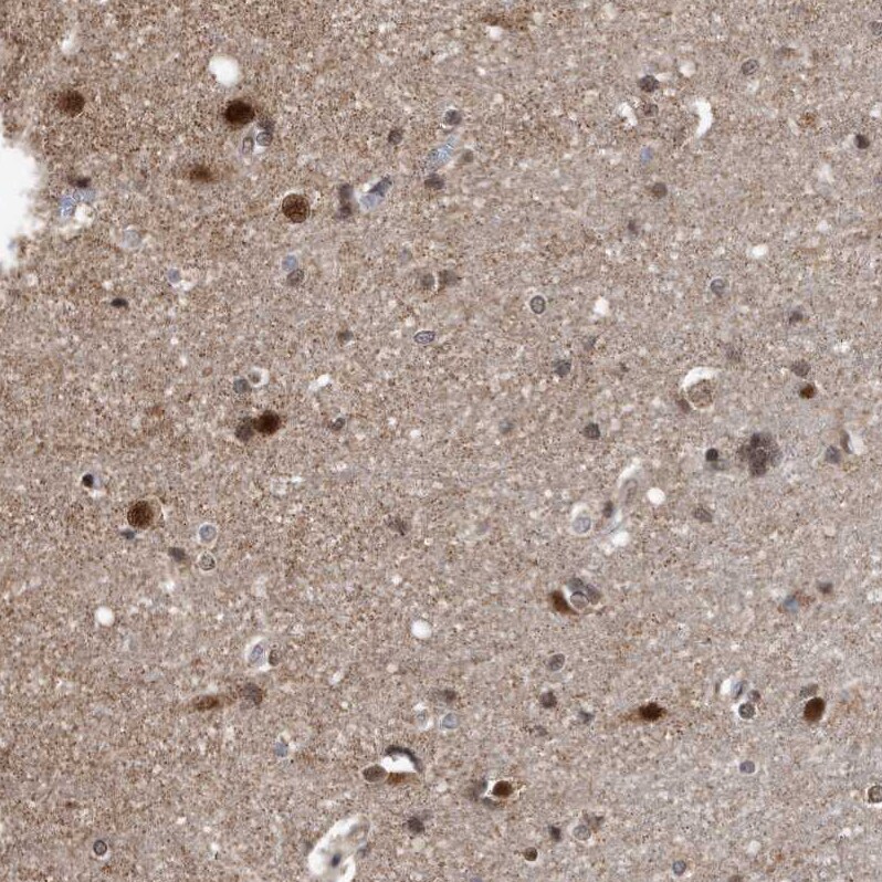 DUSP22 Antibody - BSA Free Immunohistochemistry-Paraffin: DUSP22 Antibody [NBP1-83078]