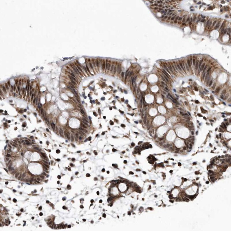 DUSP22 Antibody - BSA Free Immunohistochemistry-Paraffin: DUSP22 Antibody [NBP1-83078]