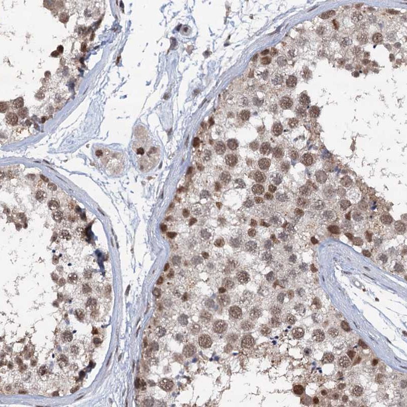 PHF8 Antibody - BSA Free Immunohistochemistry-Paraffin: PHF8 Antibody [NBP1-83079]