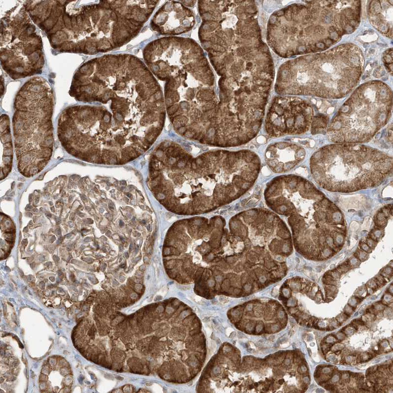 DNAJC12 Antibody - BSA Free Immunohistochemistry: DNAJC12 Antibody - BSA Free [NBP1-83083]