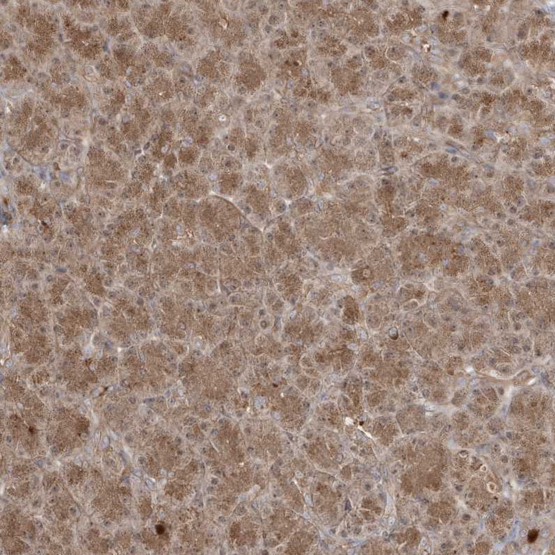DNAJC12 Antibody - BSA Free Immunohistochemistry: DNAJC12 Antibody - BSA Free [NBP1-83083]