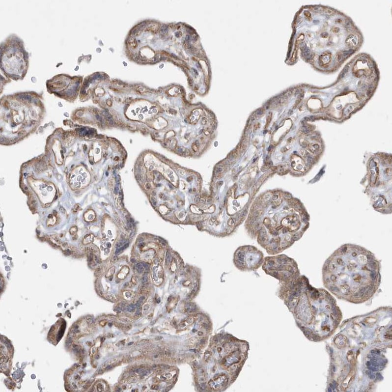 DNAJC12 Antibody - BSA Free Immunohistochemistry: DNAJC12 Antibody - BSA Free [NBP1-83083]