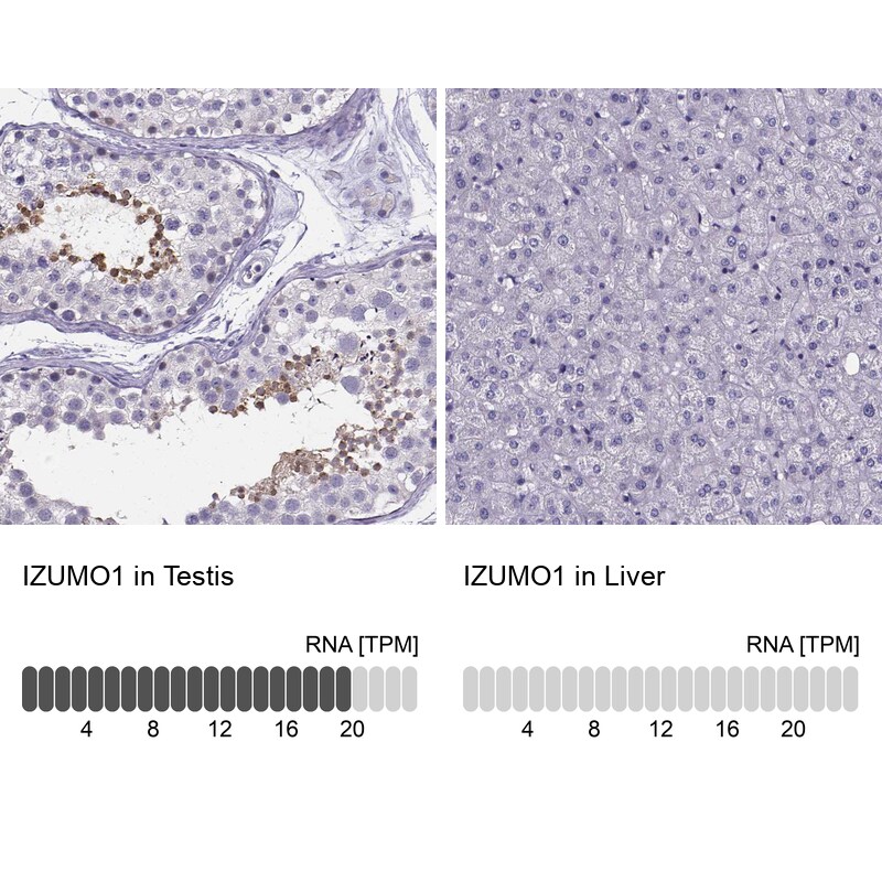 IZUMO1 Antibody - BSA Free Immunohistochemistry-Paraffin: IZUMO1 Antibody [NBP1-83086]