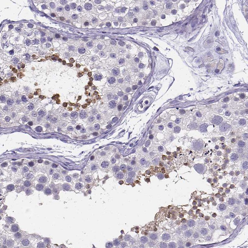 IZUMO1 Antibody - BSA Free Immunohistochemistry-Paraffin: IZUMO1 Antibody [NBP1-83086]