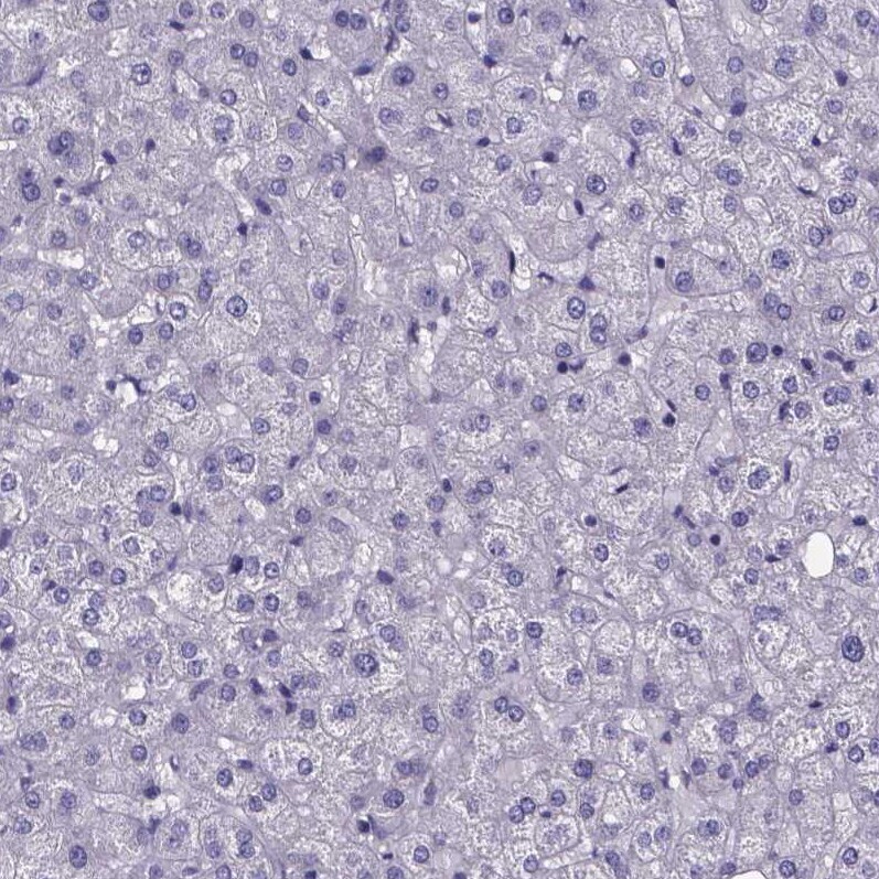 IZUMO1 Antibody - BSA Free Immunohistochemistry-Paraffin: IZUMO1 Antibody [NBP1-83086]