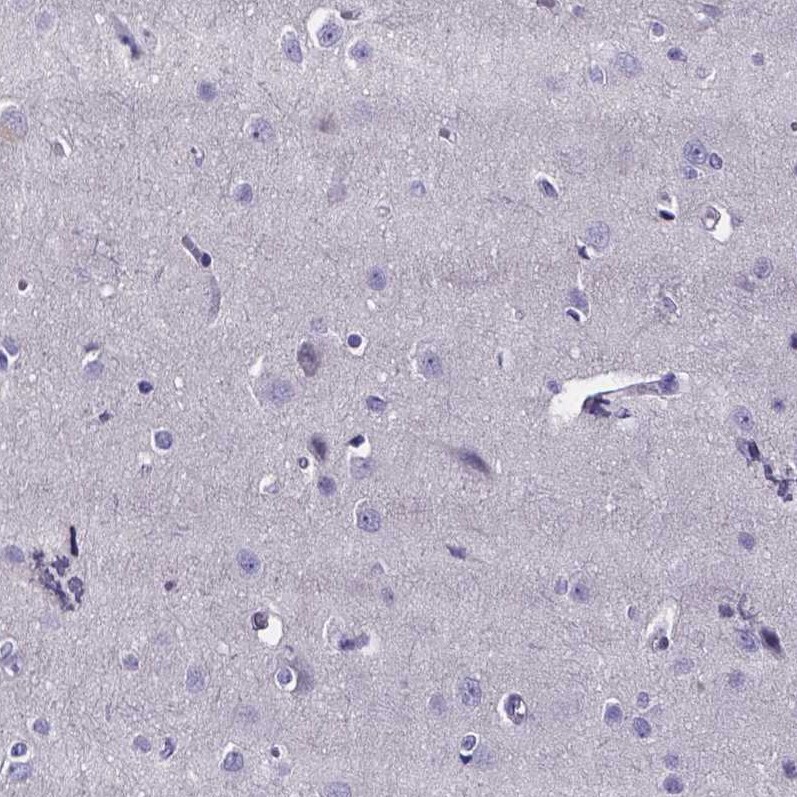 IZUMO1 Antibody - BSA Free Immunohistochemistry-Paraffin: IZUMO1 Antibody [NBP1-83086]