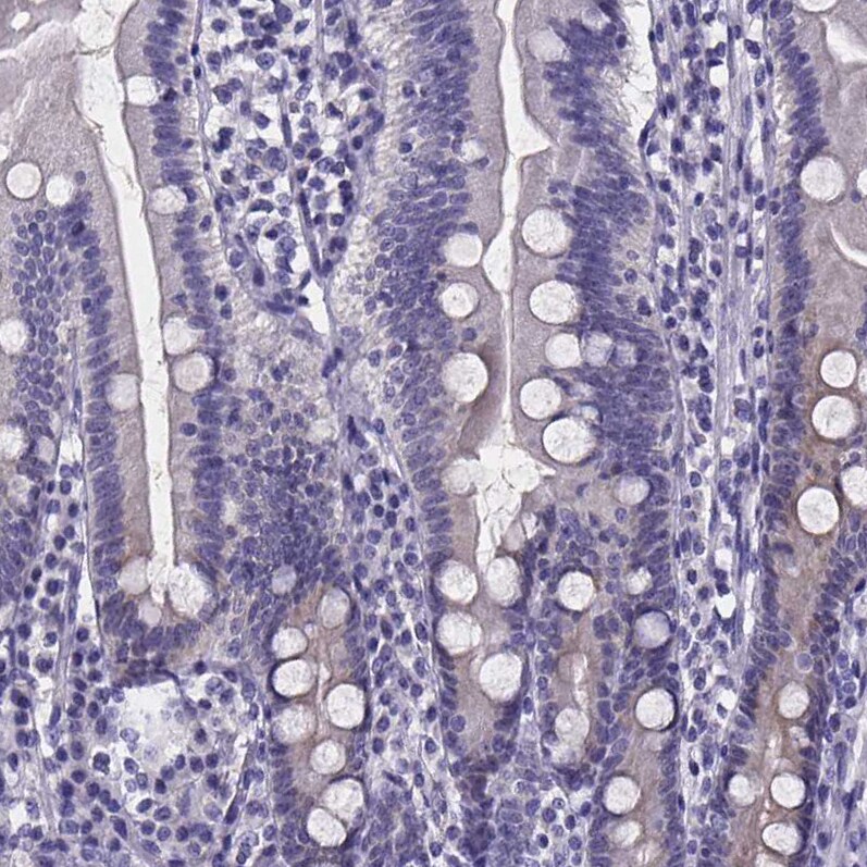 IZUMO1 Antibody - BSA Free Immunohistochemistry-Paraffin: IZUMO1 Antibody [NBP1-83086]