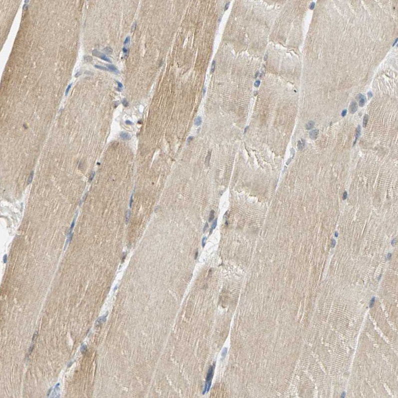 USP13 Antibody - BSA Free Immunohistochemistry-Paraffin: USP13 Antibody [NBP1-83088]