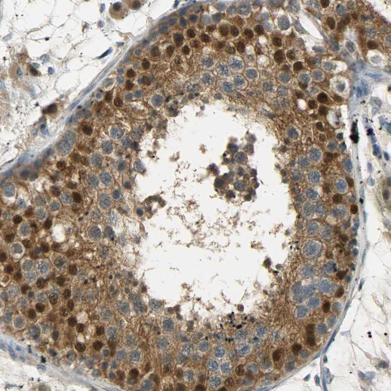 USP13 Antibody - BSA Free Immunohistochemistry-Paraffin: USP13 Antibody [NBP1-83088]