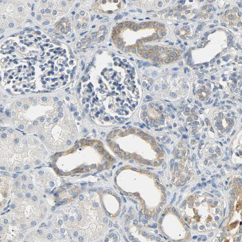 USP13 Antibody - BSA Free Immunohistochemistry-Paraffin: USP13 Antibody [NBP1-83088]