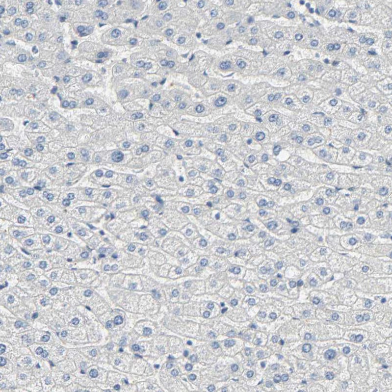 USP13 Antibody - BSA Free Immunohistochemistry-Paraffin: USP13 Antibody [NBP1-83088]