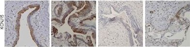 KCNJ15 Antibody