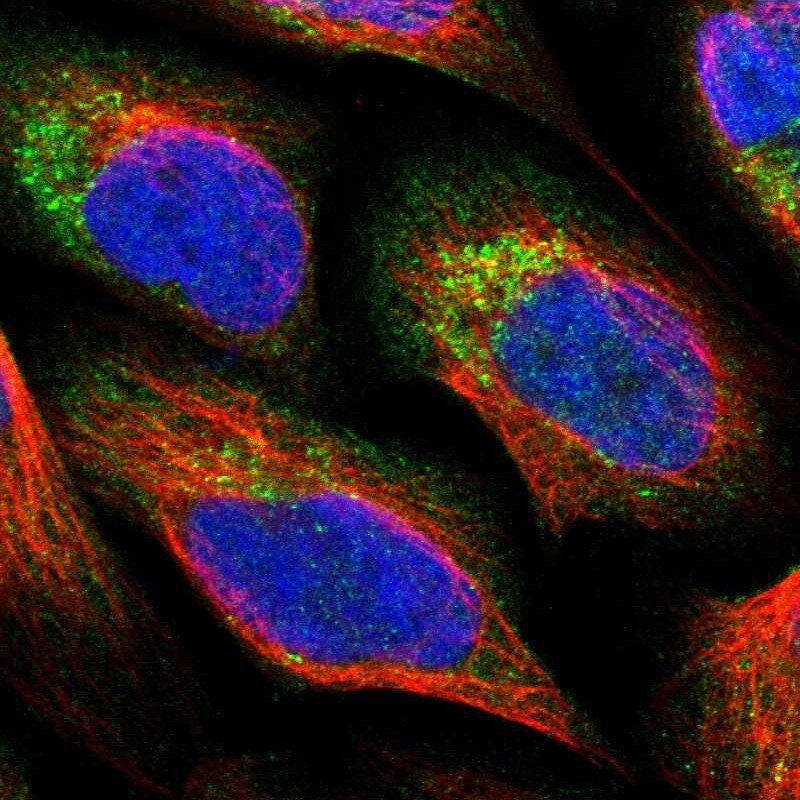 PNPLA8 Antibody - BSA Free Immunocytochemistry/ Immunofluorescence: PNPLA8 Antibody [NBP1-83098]