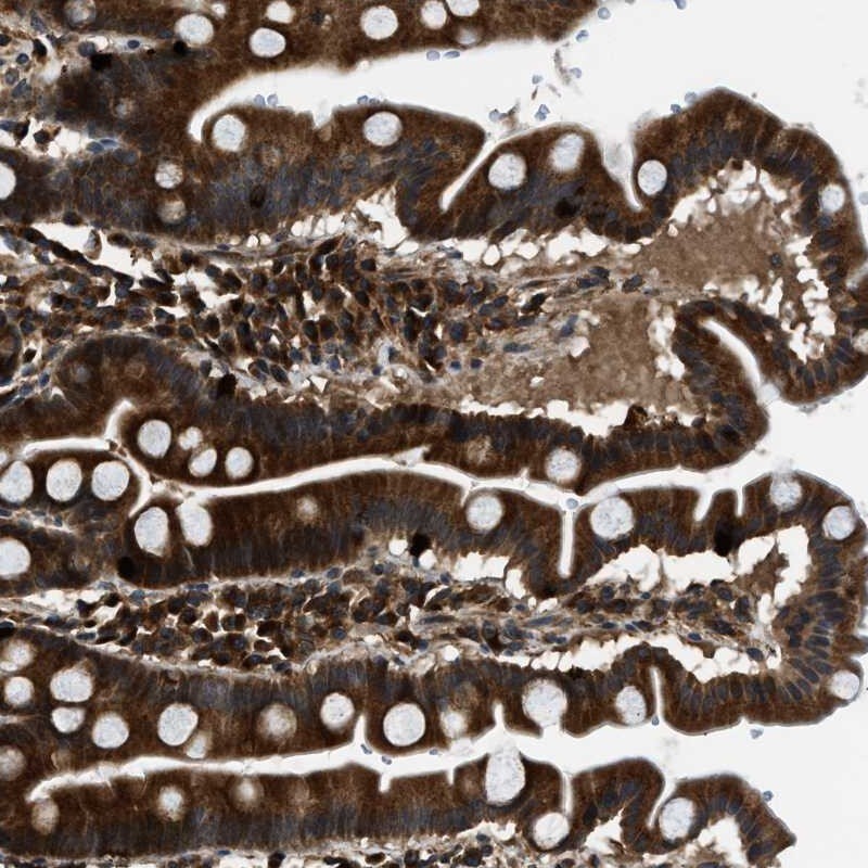 PNPLA8 Antibody - BSA Free Immunohistochemistry-Paraffin: PNPLA8 Antibody [NBP1-83098]