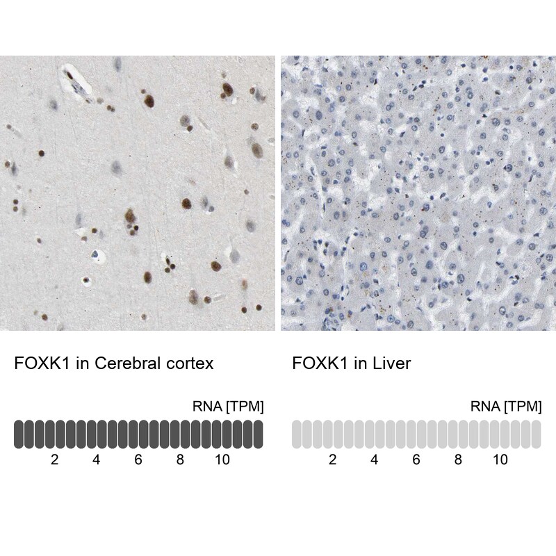 FoxK1 Antibody - BSA Free Immunohistochemistry-Paraffin: FoxK1 Antibody [NBP1-83109]